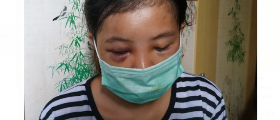 Korban Penganiayaan Pacar